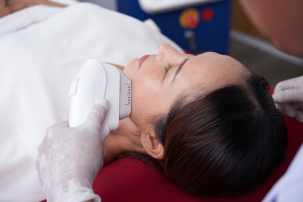 HIFU-nichtinvasive Straffung